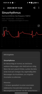 OnePlus_Watch_3_Test_EKG