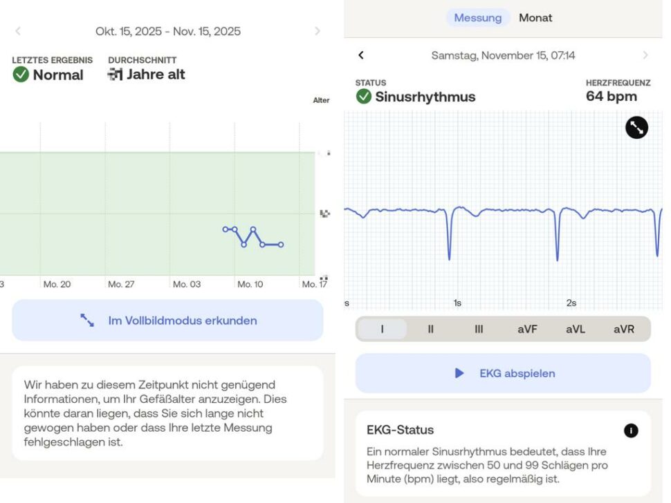 Diagramme der Withings Body Scan