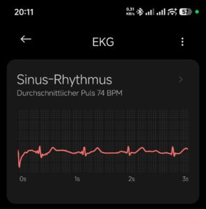 Screenshot_2026-07-28-20-11-21-397_com.xiaomi.wearable-edit