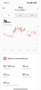 Redmi Watch 6 Puls Redmi Watch 6 Puls